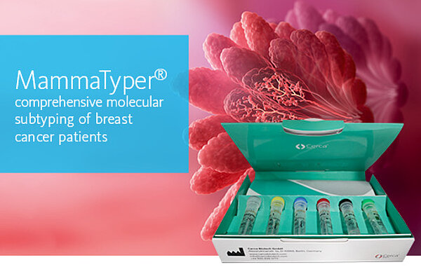 [.PL-pl Poland (polish)] MammaTyper® comprehensive molecular subtyping of breast cancer patients
