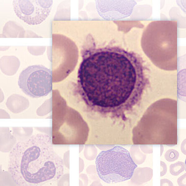 Sysmex Cellspotting Quiz